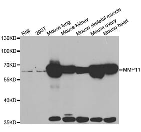 Western blot - MMP11 antibody from Signalway Antibody (38546) - Antibodies.com