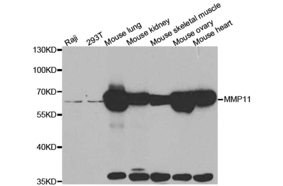 Western blot - MMP11 antibody from Signalway Antibody (38546) - Antibodies.com
