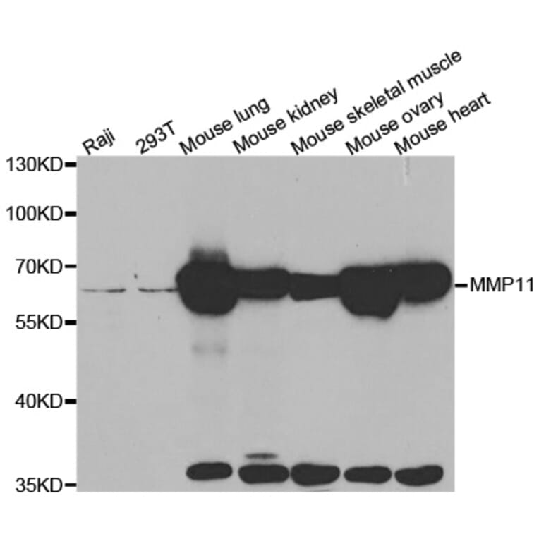 Western blot - MMP11 antibody from Signalway Antibody (38546) - Antibodies.com