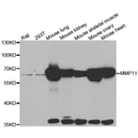 Western blot - MMP11 antibody from Signalway Antibody (38546) - Antibodies.com