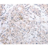 Immunohistochemistry - MMP11 antibody from Signalway Antibody (38546) - Antibodies.com