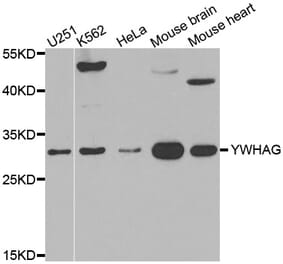 Western blot - YWHAG antibody from Signalway Antibody (38549) - Antibodies.com