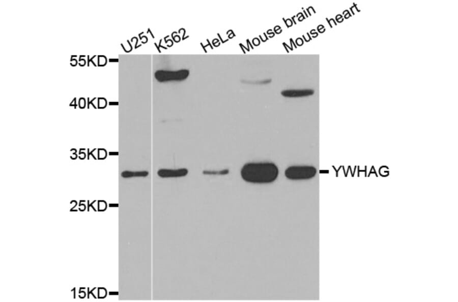 Western blot - YWHAG antibody from Signalway Antibody (38549) - Antibodies.com