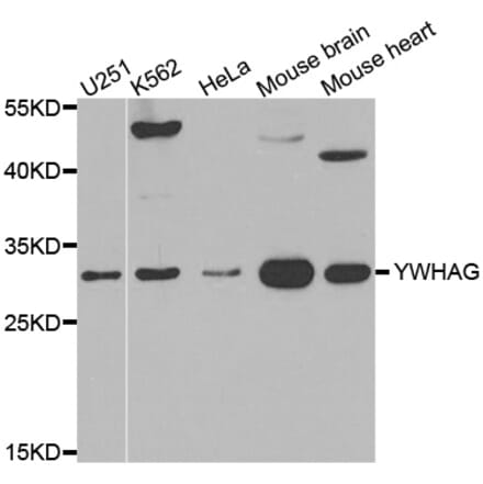 Western blot - YWHAG antibody from Signalway Antibody (38549) - Antibodies.com