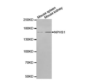 Western blot - NPHS1 antibody from Signalway Antibody (38552) - Antibodies.com