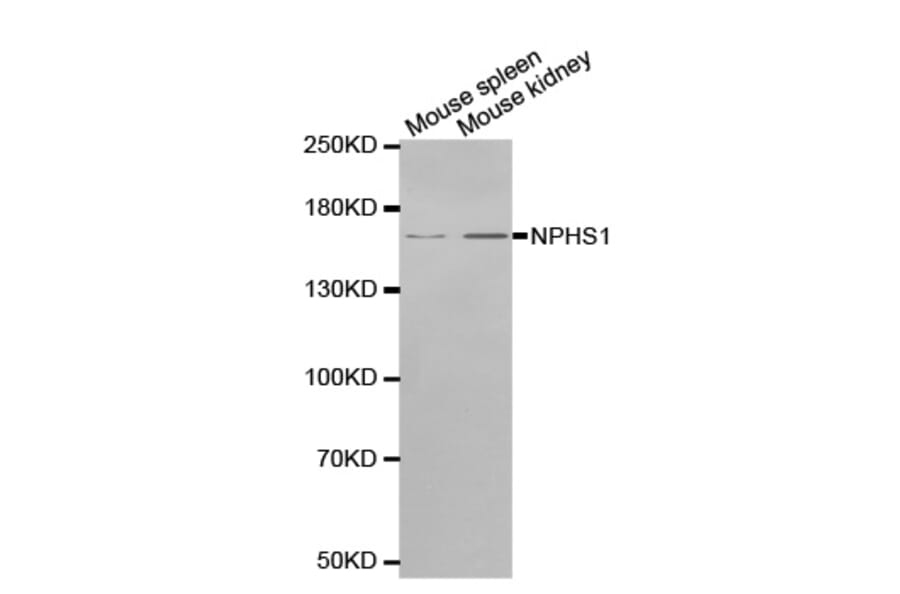 Western blot - NPHS1 antibody from Signalway Antibody (38552) - Antibodies.com