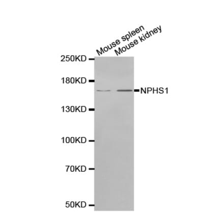 Western blot - NPHS1 antibody from Signalway Antibody (38552) - Antibodies.com