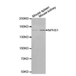 Western blot - NPHS1 antibody from Signalway Antibody (38552) - Antibodies.com
