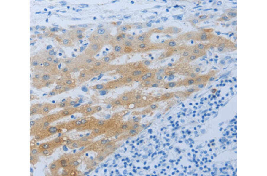 Immunohistochemistry - NPHS1 antibody from Signalway Antibody (38552) - Antibodies.com