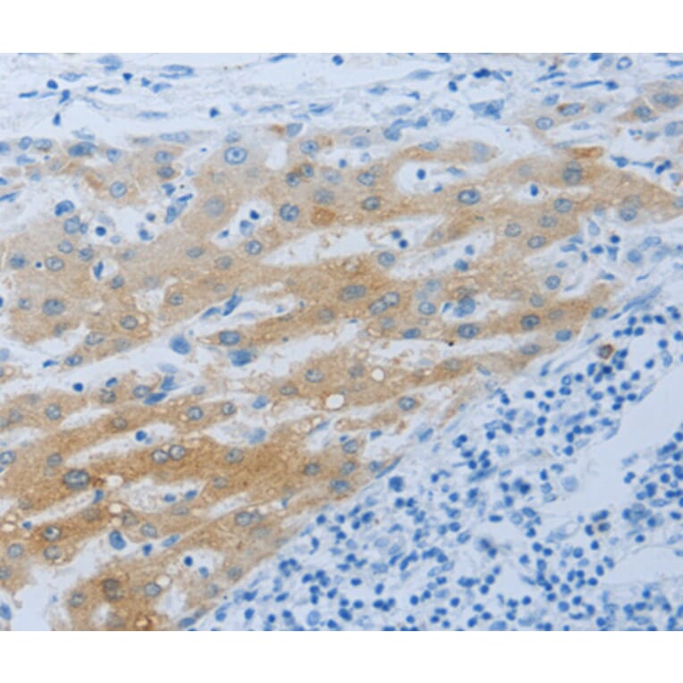Immunohistochemistry - NPHS1 antibody from Signalway Antibody (38552) - Antibodies.com