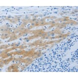 Immunohistochemistry - NPHS1 antibody from Signalway Antibody (38552) - Antibodies.com