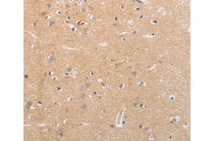 Immunohistochemistry - NFASC antibody from Signalway Antibody (38553) - Antibodies.com