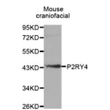 Western blot - P2RY4 antibody from Signalway Antibody (38556) - Antibodies.com