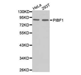 Western blot - PIBF1 antibody from Signalway Antibody (38564) - Antibodies.com