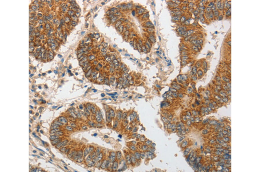 Immunohistochemistry - PIBF1 antibody from Signalway Antibody (38564) - Antibodies.com