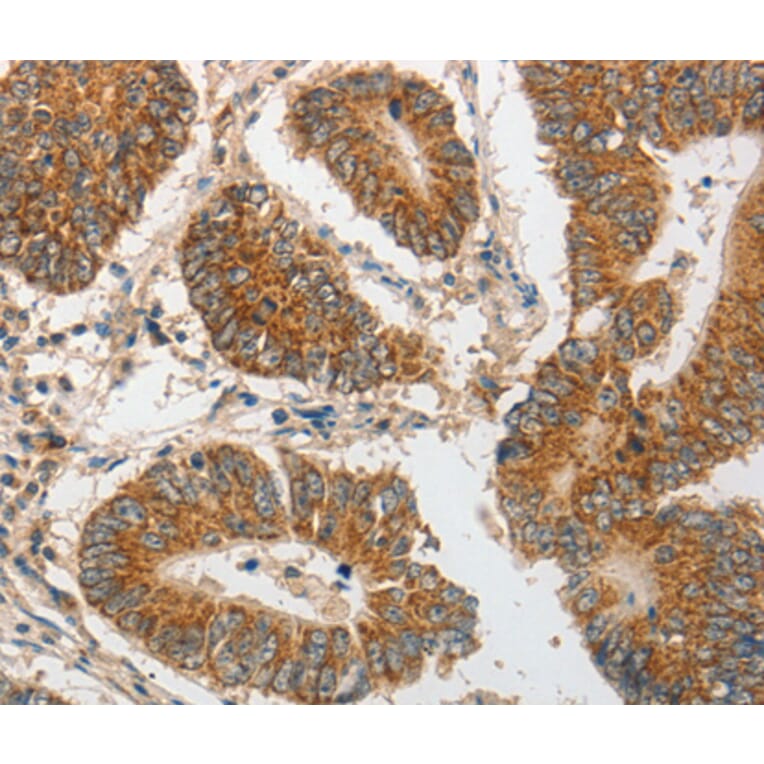 Immunohistochemistry - PIBF1 antibody from Signalway Antibody (38564) - Antibodies.com