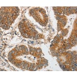 Immunohistochemistry - PIBF1 antibody from Signalway Antibody (38564) - Antibodies.com