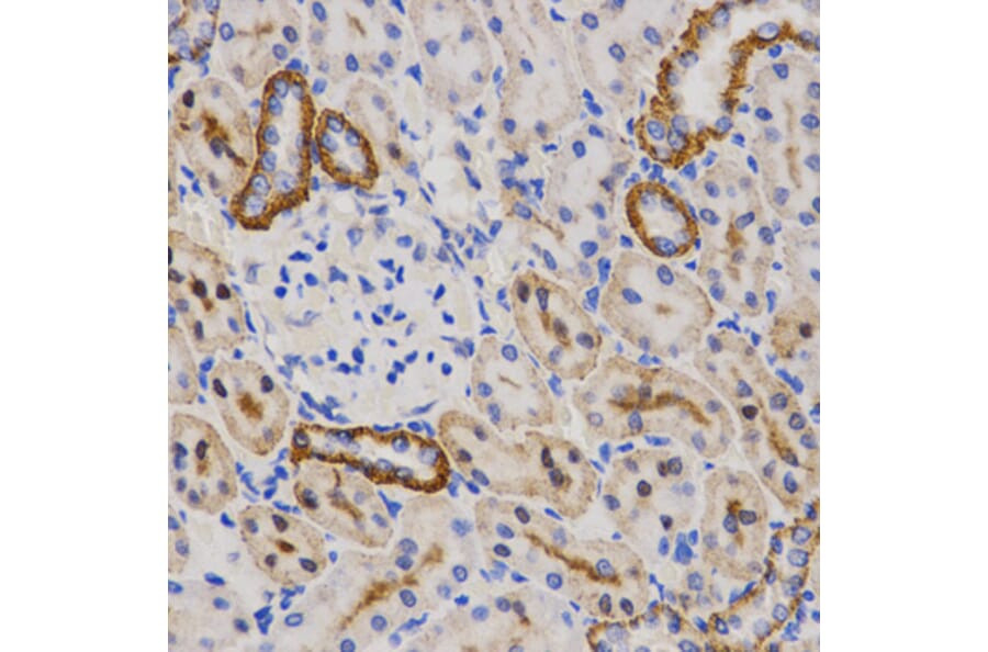 Immunohistochemistry - PIBF1 antibody from Signalway Antibody (38564) - Antibodies.com