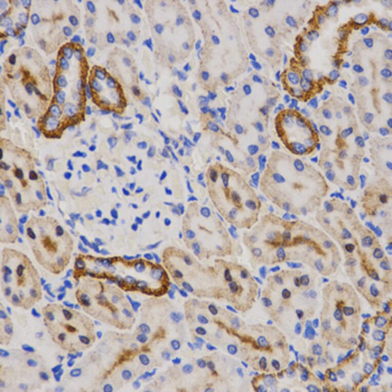 Immunohistochemistry - PIBF1 antibody from Signalway Antibody (38564) - Antibodies.com