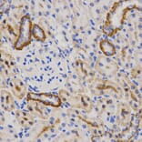 Immunohistochemistry - PIBF1 antibody from Signalway Antibody (38564) - Antibodies.com