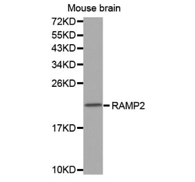 Western blot - RAMP2 antibody from Signalway Antibody (38566) - Antibodies.com