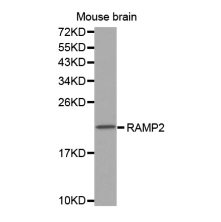 Western blot - RAMP2 antibody from Signalway Antibody (38566) - Antibodies.com