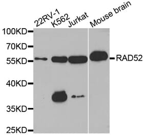 Western blot - RAD52 antibody from Signalway Antibody (38568) - Antibodies.com