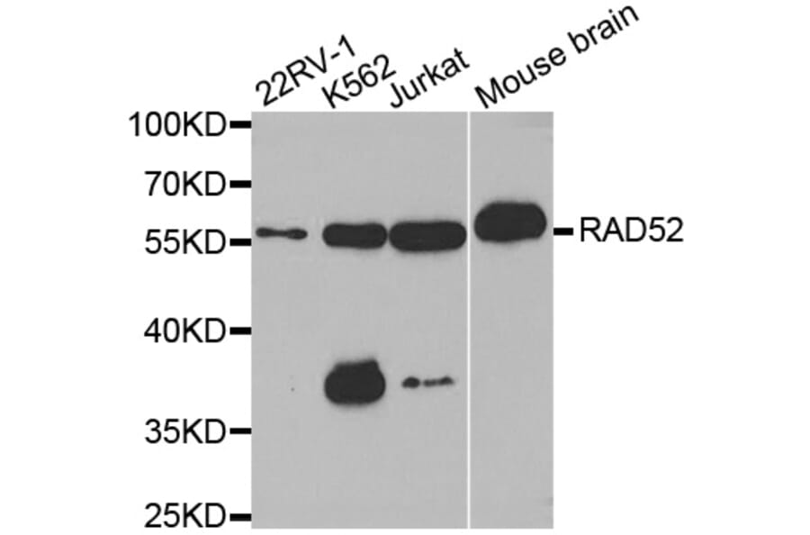 Western blot - RAD52 antibody from Signalway Antibody (38568) - Antibodies.com