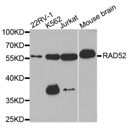 Western blot - RAD52 antibody from Signalway Antibody (38568) - Antibodies.com