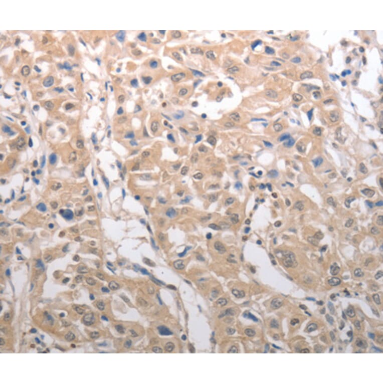 Immunohistochemistry - RAD52 antibody from Signalway Antibody (38568) - Antibodies.com