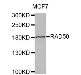 Western blot - RAD50 antibody from Signalway Antibody (38569) - Antibodies.com