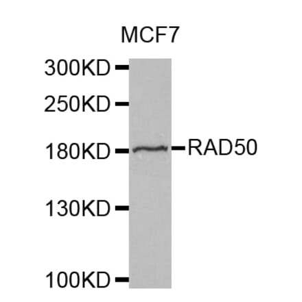 Western blot - RAD50 antibody from Signalway Antibody (38569) - Antibodies.com