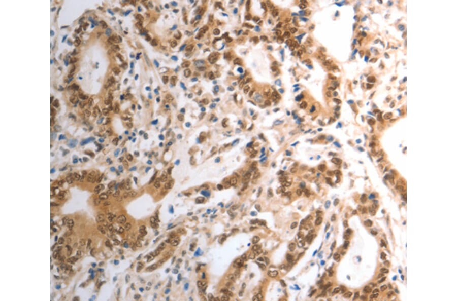 Immunohistochemistry - RAD50 antibody from Signalway Antibody (38569) - Antibodies.com