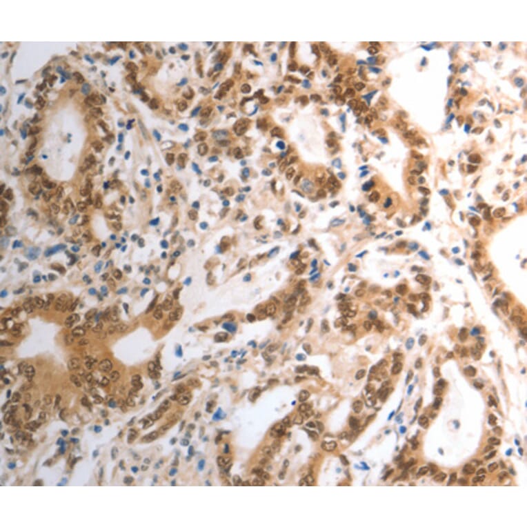 Immunohistochemistry - RAD50 antibody from Signalway Antibody (38569) - Antibodies.com