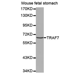 Western blot - TRAF7 antibody from Signalway Antibody (38575) - Antibodies.com