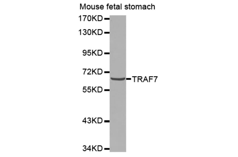 Western blot - TRAF7 antibody from Signalway Antibody (38575) - Antibodies.com