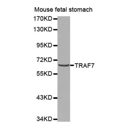 Western blot - TRAF7 antibody from Signalway Antibody (38575) - Antibodies.com