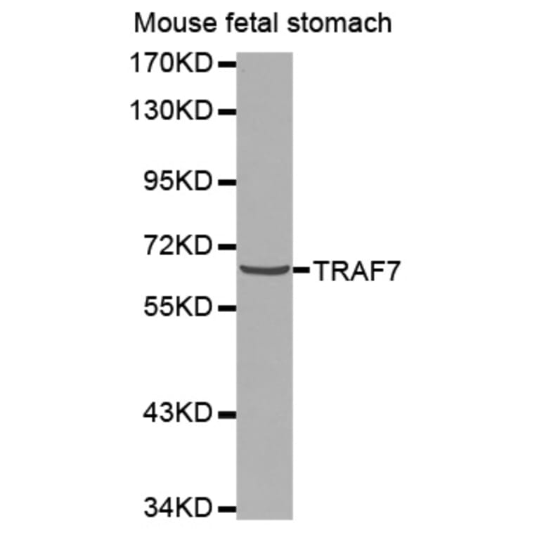 Western blot - TRAF7 antibody from Signalway Antibody (38575) - Antibodies.com