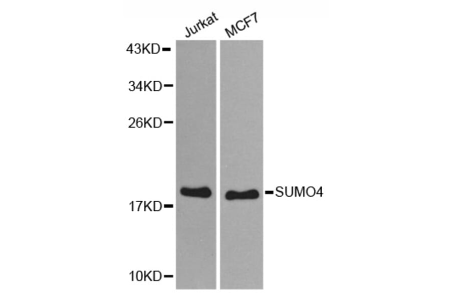 Western blot - SUMO4 antibody from Signalway Antibody (38579) - Antibodies.com