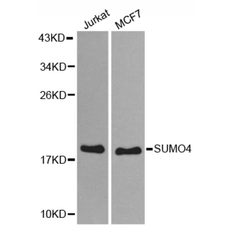 Western blot - SUMO4 antibody from Signalway Antibody (38579) - Antibodies.com