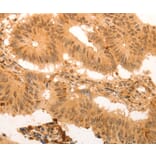 Immunohistochemistry - SUMO4 antibody from Signalway Antibody (38579) - Antibodies.com
