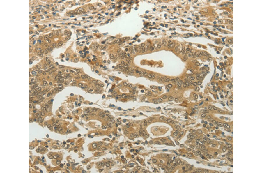 Immunohistochemistry - MYSM1 antibody from Signalway Antibody (38581) - Antibodies.com