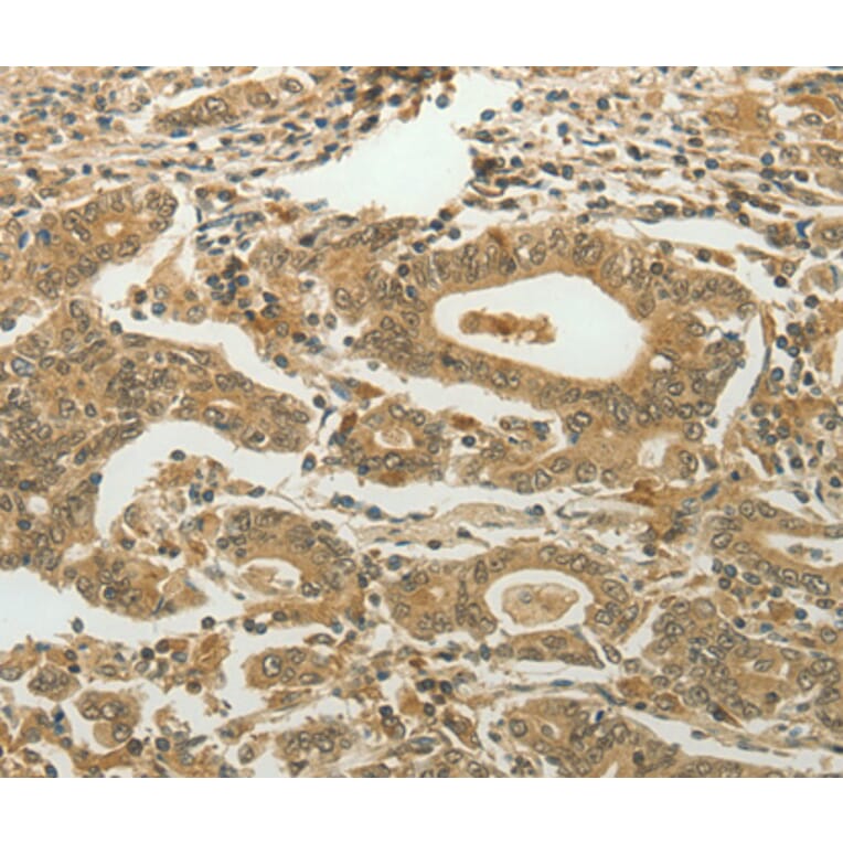 Immunohistochemistry - MYSM1 antibody from Signalway Antibody (38581) - Antibodies.com