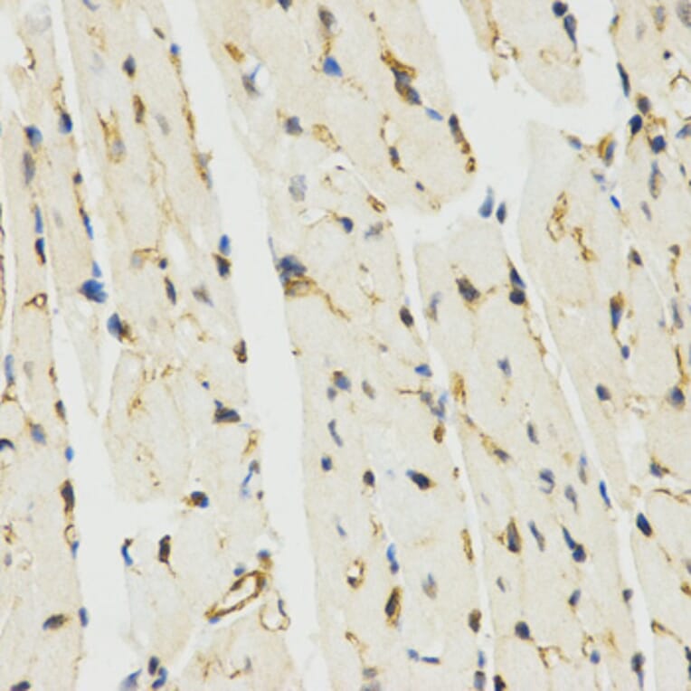 Immunohistochemistry - MYSM1 antibody from Signalway Antibody (38581) - Antibodies.com