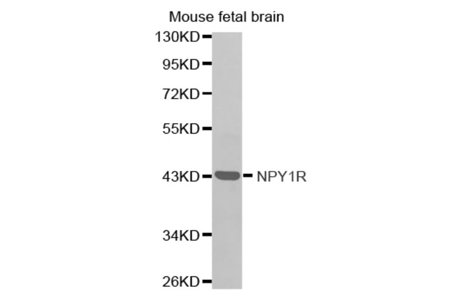Western blot - NPY1R antibody from Signalway Antibody (38588) - Antibodies.com