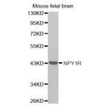 Western blot - NPY1R antibody from Signalway Antibody (38588) - Antibodies.com