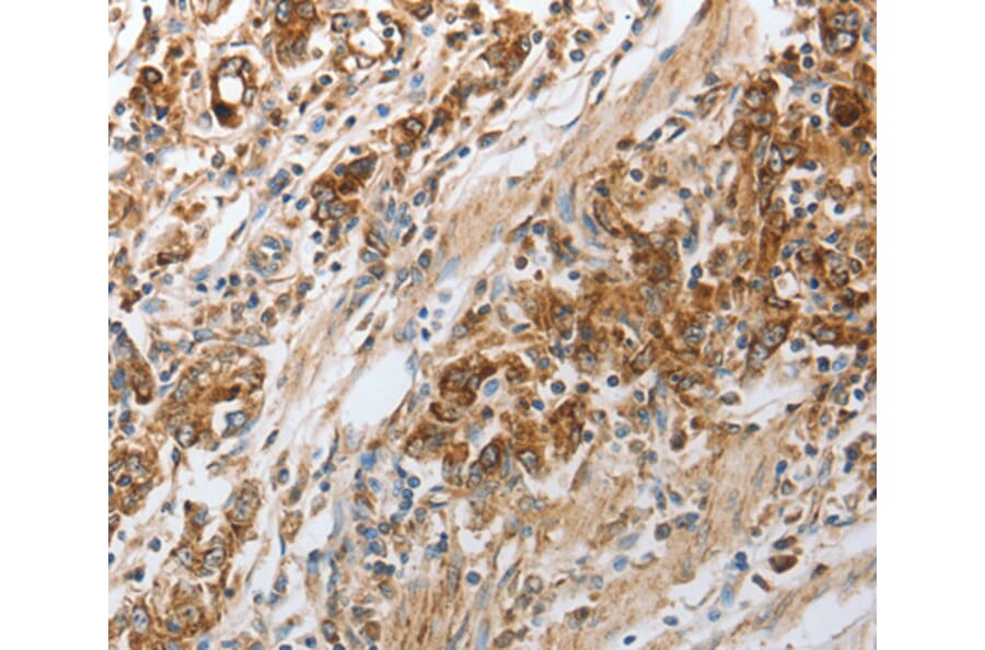 Immunohistochemistry - NPY1R antibody from Signalway Antibody (38588) - Antibodies.com