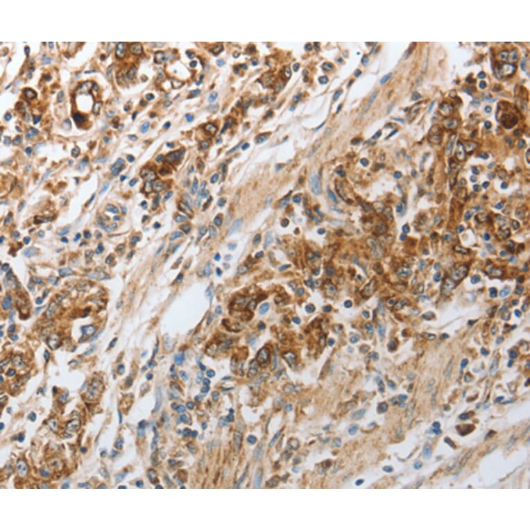 Immunohistochemistry - NPY1R antibody from Signalway Antibody (38588) - Antibodies.com