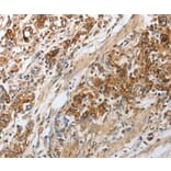 Immunohistochemistry - NPY1R antibody from Signalway Antibody (38588) - Antibodies.com