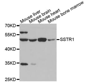 Western blot - SSTR1 antibody from Signalway Antibody (38599) - Antibodies.com